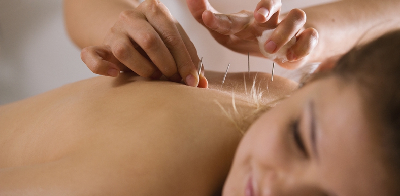 woman receiving acupuncture treatment