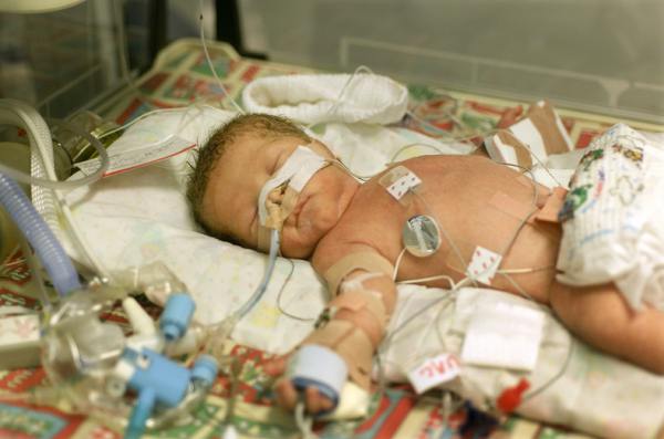 Baby in intensive care unit.